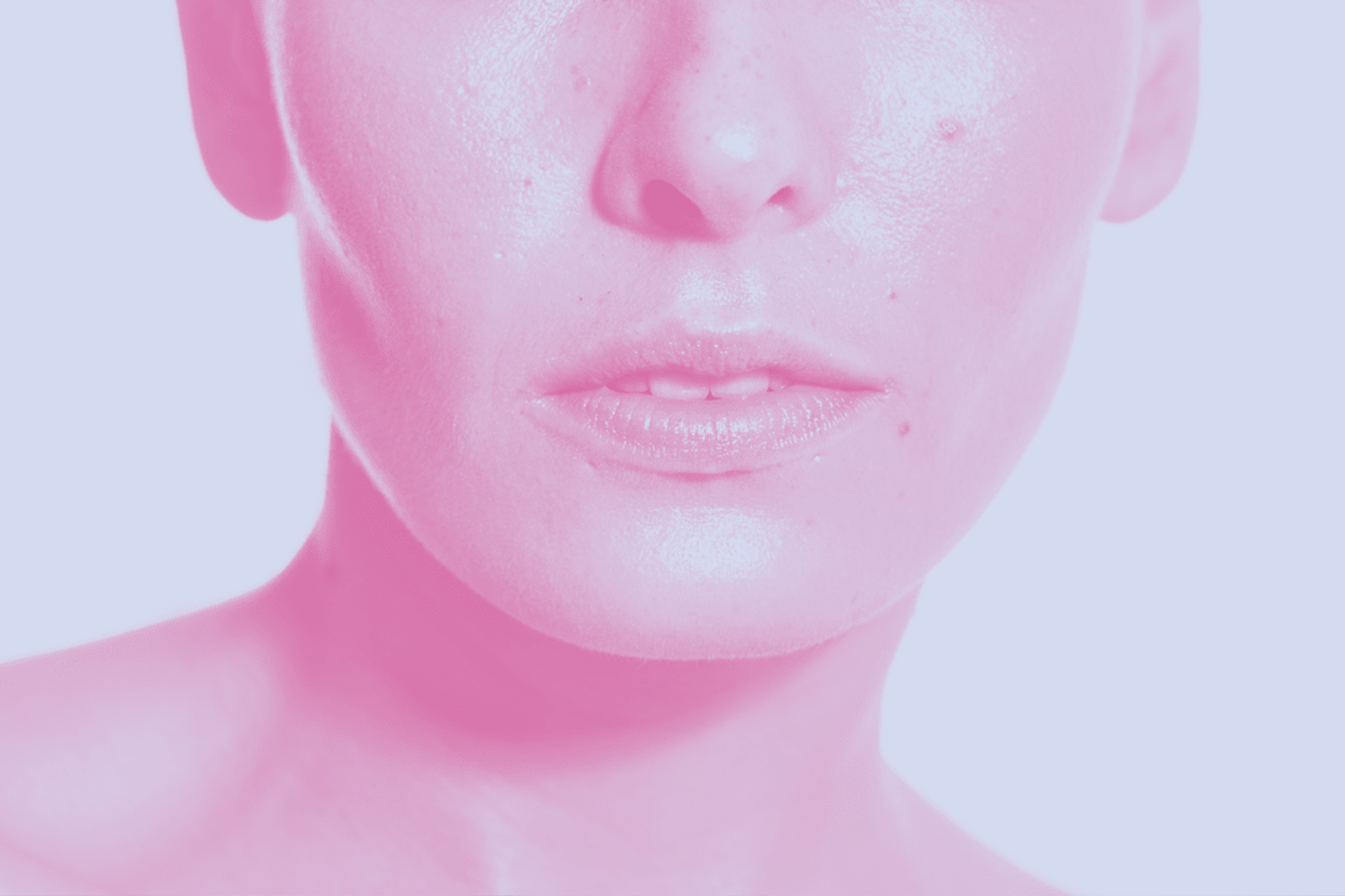 Dryness, excessive oiliness, or disruption of the skin microbiome