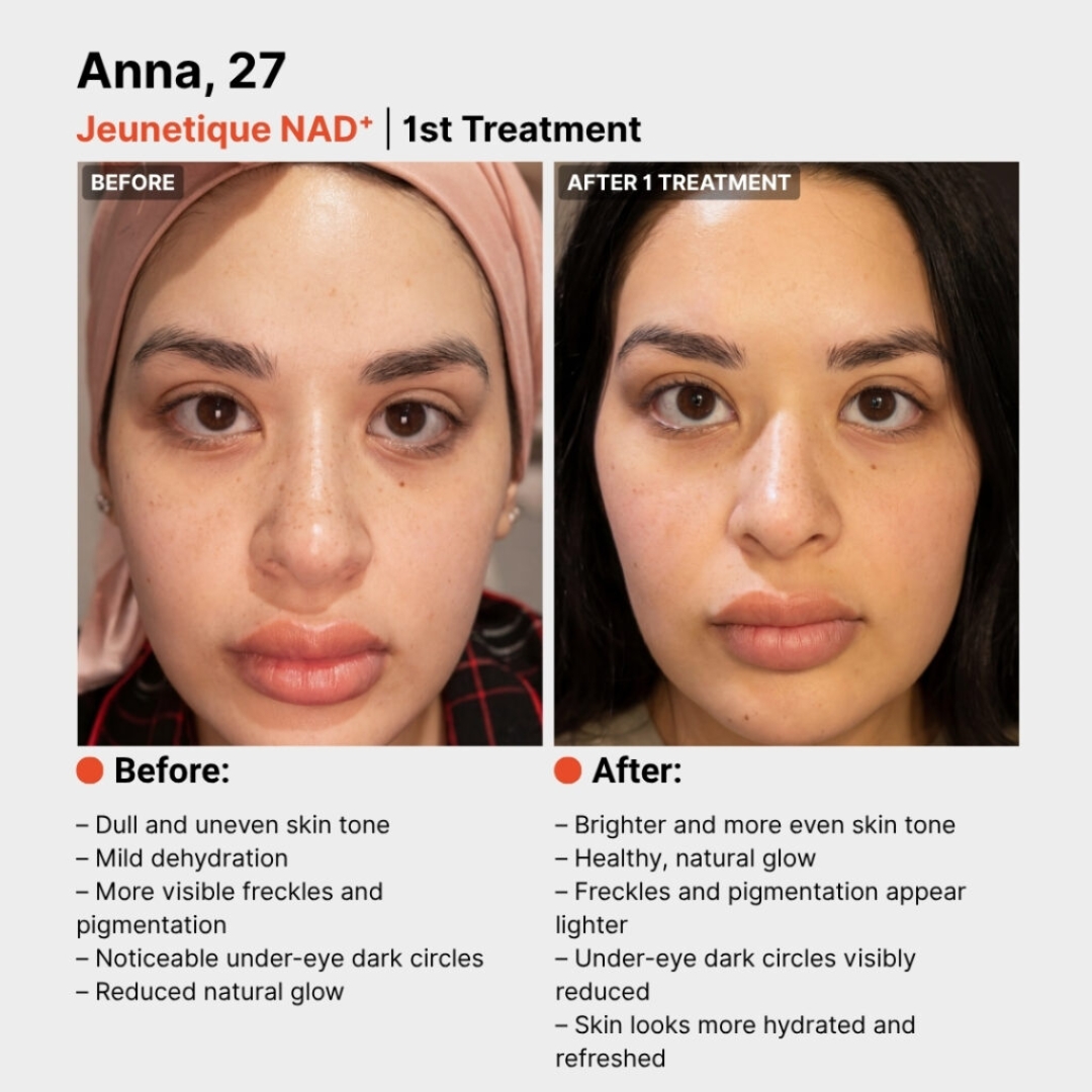Jeunetique NAD+ before and after result 2