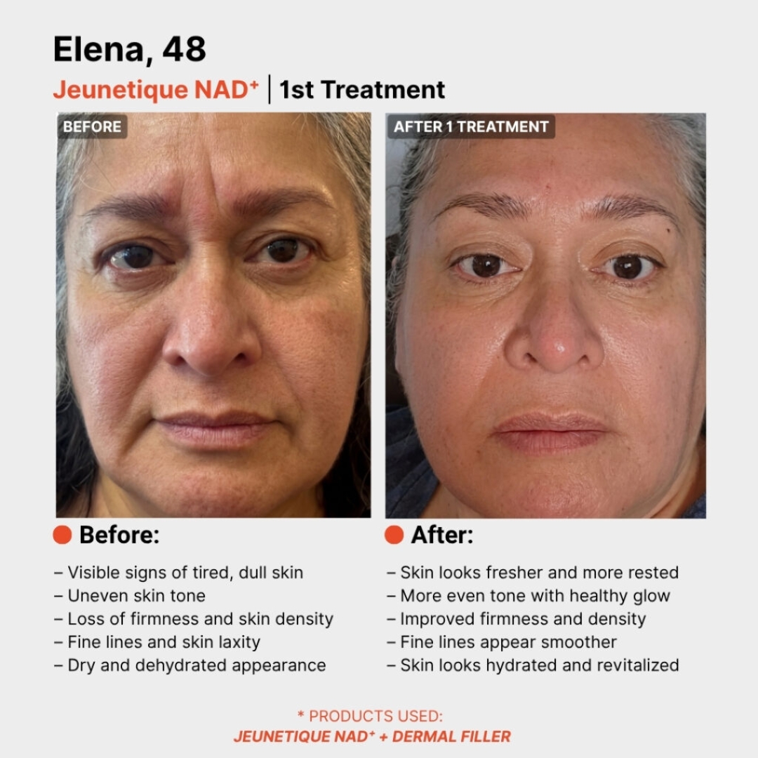 Jeunetique NAD+ before and after result 1