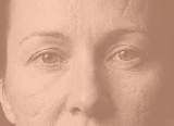 Uneven texture, minor scars and post-acne marks