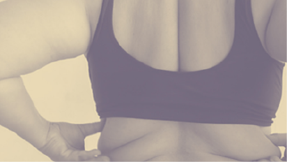 Axillary, upper arm and lateral shoulder blade fat deposits.