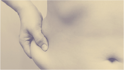Excessive fat deposits in the abdomen, buttocks, thighs or waist.